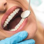 What is Enamel Erosion?