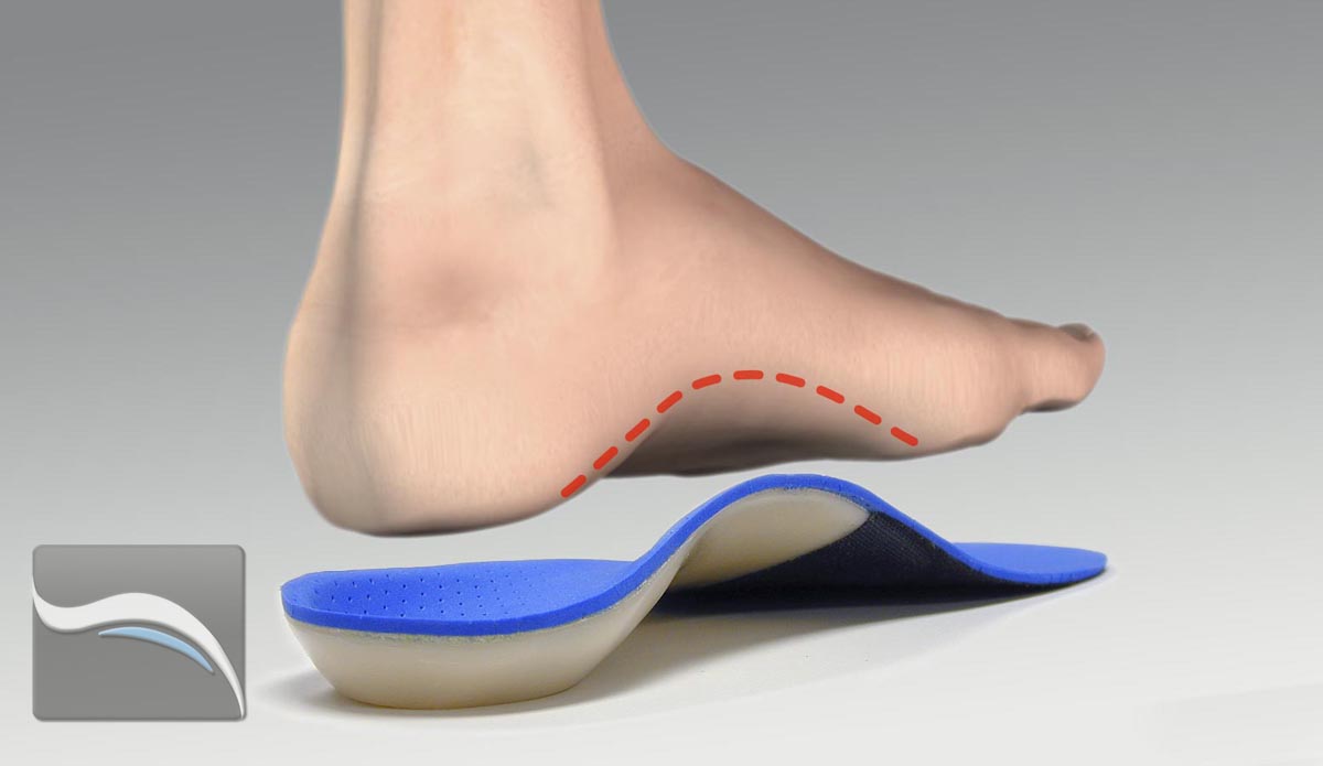 Custom on sale orthotic insoles