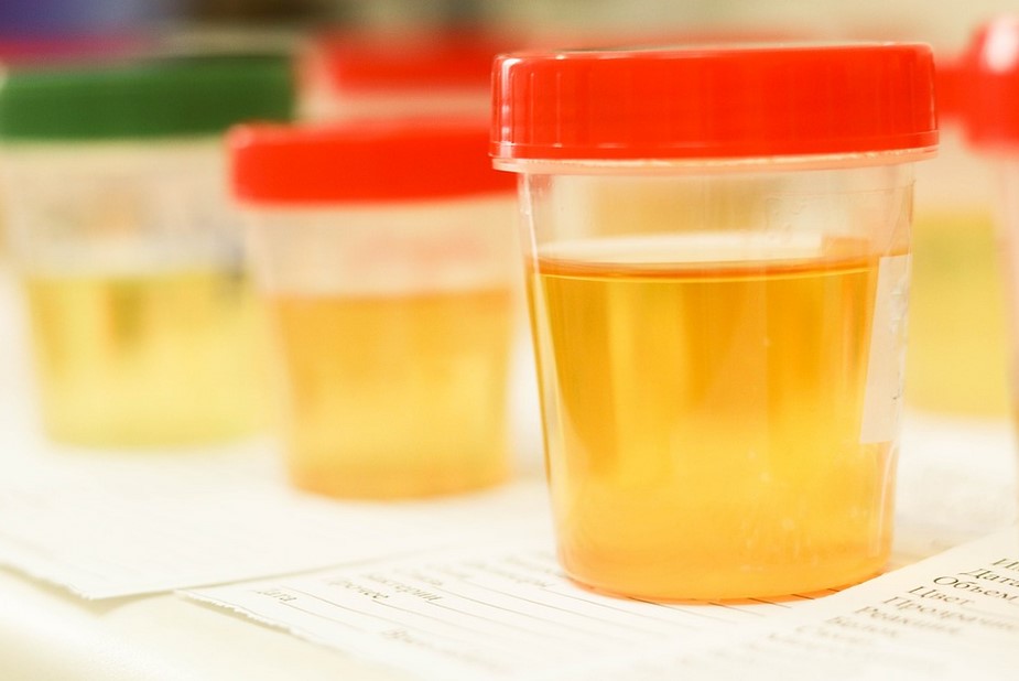 Can You Freeze Urine For Future Drug Tests?