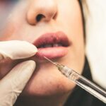 Achieving Wrinkle-Free Skin: The Benefits and Considerations of Botox Treatment