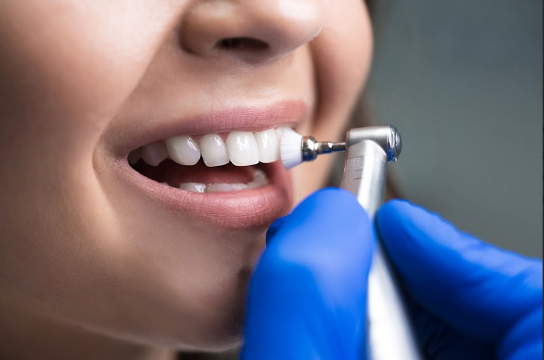 Understanding The Full Scope: What Is Included In A Dental Cleaning?