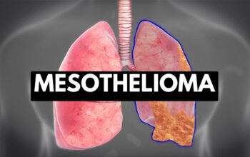 Mesothelioma