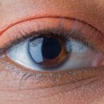 Laser Eye Surgery in London for Different Age Groups